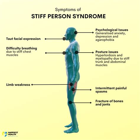 what is life expectancy for stiff person syndrome